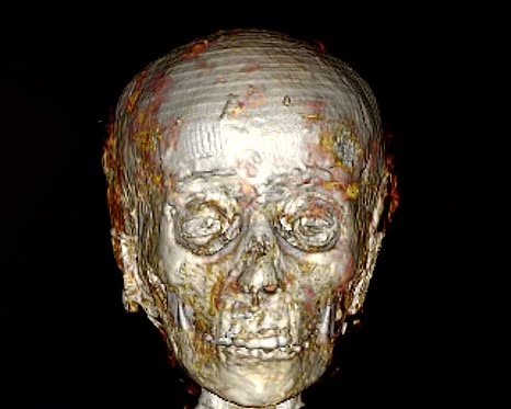 Учёные воссоздали лицо «золотого мальчика» — египетской мумии возрастом 2 300 лет